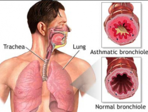 saluran bronki (bronchiale).